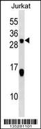 Stathmin-2 antibody, 58-226, ProSci, Western Blot image 