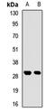Ribonuclease P/MRP Subunit P30 antibody, orb412746, Biorbyt, Western Blot image 