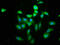 PIH1 Domain Containing 1 antibody, CSB-PA889130LA01HU, Cusabio, Immunofluorescence image 