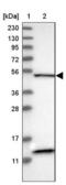 SET Domain Containing 4 antibody, NBP1-88279, Novus Biologicals, Western Blot image 