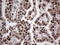 RAD23 Homolog B, Nucleotide Excision Repair Protein antibody, LS-C790415, Lifespan Biosciences, Immunohistochemistry paraffin image 