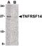 TNF Receptor Superfamily Member 14 antibody, PA5-20236, Invitrogen Antibodies, Western Blot image 