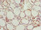 Peripherin antibody, LS-C676315, Lifespan Biosciences, Immunohistochemistry paraffin image 