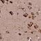 Lysyl-TRNA Synthetase antibody, PA5-59620, Invitrogen Antibodies, Immunohistochemistry paraffin image 