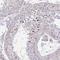 Chromosome 19 Open Reading Frame 54 antibody, PA5-63758, Invitrogen Antibodies, Immunohistochemistry frozen image 