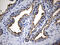 Phosphoinositide Kinase, FYVE-Type Zinc Finger Containing antibody, M02638, Boster Biological Technology, Immunohistochemistry paraffin image 