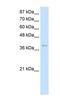 Protein Arginine Methyltransferase 1 antibody, NBP1-56501, Novus Biologicals, Western Blot image 