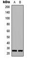 Fibroblast Growth Factor 17 antibody, LS-C354359, Lifespan Biosciences, Western Blot image 