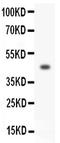 Homeobox A3 antibody, GTX11945, GeneTex, Western Blot image 