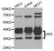 Uracil DNA Glycosylase antibody, STJ29843, St John
