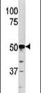 Phosphoglycerate Kinase 2 antibody, PA5-13974, Invitrogen Antibodies, Western Blot image 