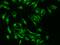 Small Ubiquitin Like Modifier 4 antibody, GTX02349, GeneTex, Immunofluorescence image 
