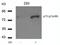 Tumor Protein P73 antibody, GTX50132, GeneTex, Western Blot image 