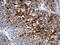 Plasminogen antibody, M00702, Boster Biological Technology, Immunohistochemistry paraffin image 