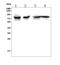 TNF Receptor Superfamily Member 11a antibody, A01064-3, Boster Biological Technology, Western Blot image 