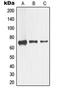 Nerve Growth Factor Receptor antibody, LS-C352595, Lifespan Biosciences, Western Blot image 