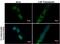 Microtubule Associated Protein 1 Light Chain 3 Beta antibody, PA5-30598, Invitrogen Antibodies, Immunofluorescence image 