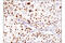 Prospero Homeobox 1 antibody, 14963S, Cell Signaling Technology, Immunohistochemistry paraffin image 