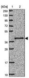 Pre-MRNA Processing Factor 18 antibody, PA5-61629, Invitrogen Antibodies, Western Blot image 