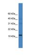 Mitogen-Activated Protein Kinase Binding Protein 1 antibody, orb325963, Biorbyt, Western Blot image 