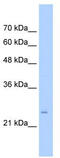 Transmembrane Protein 69 antibody, TA342015, Origene, Western Blot image 