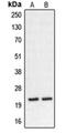 Calcineurin Like EF-Hand Protein 2 antibody, orb215255, Biorbyt, Western Blot image 