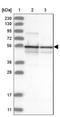 Annexin A11 antibody, NBP1-90160, Novus Biologicals, Western Blot image 
