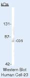 CD5 Molecule antibody, MA5-14560, Invitrogen Antibodies, Western Blot image 
