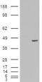 Poly(RC) Binding Protein 4 antibody, NB100-68152, Novus Biologicals, Western Blot image 