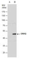 G Protein Subunit Alpha Q antibody, GTX104544, GeneTex, Western Blot image 