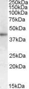 Adrenocorticotropic hormone receptor antibody, MBS420719, MyBioSource, Western Blot image 