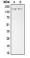 Collagen Type XI Alpha 1 Chain antibody, MBS821311, MyBioSource, Western Blot image 