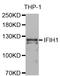 Interferon Induced With Helicase C Domain 1 antibody, A13645, ABclonal Technology, Western Blot image 