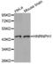 Heterogeneous Nuclear Ribonucleoprotein H1 antibody, LS-C334386, Lifespan Biosciences, Western Blot image 