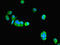 Patatin Like Phospholipase Domain Containing 1 antibody, LS-C397579, Lifespan Biosciences, Immunofluorescence image 