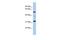 TBC1 Domain Family Member 26 antibody, GTX45196, GeneTex, Western Blot image 