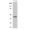 Docking Protein 6 antibody, LS-C383178, Lifespan Biosciences, Western Blot image 