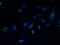 Cilia And Flagella Associated Protein 65 antibody, A58454-100, Epigentek, Immunofluorescence image 