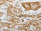 Leptin Receptor antibody, CSB-PA914116, Cusabio, Immunohistochemistry paraffin image 