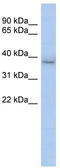 Kelch Domain Containing 8B antibody, TA346661, Origene, Western Blot image 