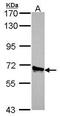 Acyl-CoA Oxidase 3, Pristanoyl antibody, PA5-22373, Invitrogen Antibodies, Western Blot image 