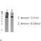 Glucagon-like peptide 1 receptor antibody, LS-C813422, Lifespan Biosciences, Western Blot image 