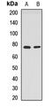 Protein Phosphatase 2 Regulatory Subunit B''Beta antibody, LS-C668730, Lifespan Biosciences, Western Blot image 