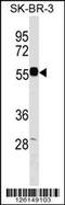 Endonuclease/Exonuclease/Phosphatase Family Domain Containing 1 antibody, 59-692, ProSci, Western Blot image 