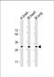 Cholesterol 25-Hydroxylase antibody, PA5-72349, Invitrogen Antibodies, Western Blot image 