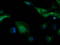 Tubulin Beta 4A Class IVa antibody, LS-C173072, Lifespan Biosciences, Immunofluorescence image 