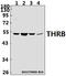 Thyroid Hormone Receptor Beta antibody, A01181-1, Boster Biological Technology, Western Blot image 