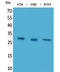 BRMS1 Transcriptional Repressor And Anoikis Regulator antibody, STJ96523, St John