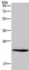 Adenylate Kinase 1 antibody, TA321144, Origene, Western Blot image 
