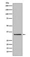 Calcium release-activated calcium channel protein 1 antibody, M00909-1, Boster Biological Technology, Western Blot image 